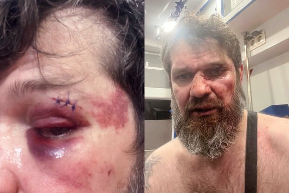 Activist Georgii Vorontsov in an ambulance after being beaten, October 8, 2022 / Photo provided by Vorontsov